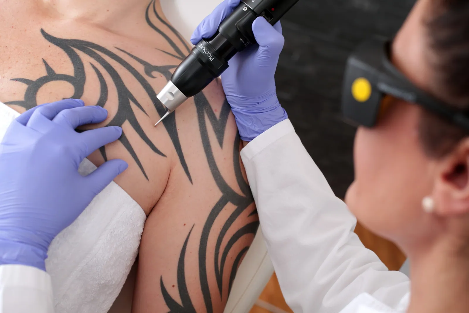 Tattoo- & PMU-Entfernung